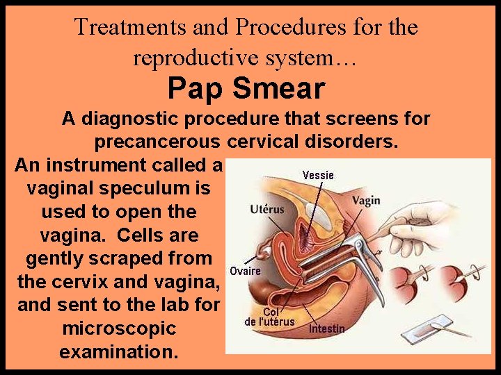 Treatments and Procedures for the reproductive system… Pap Smear A diagnostic procedure that screens