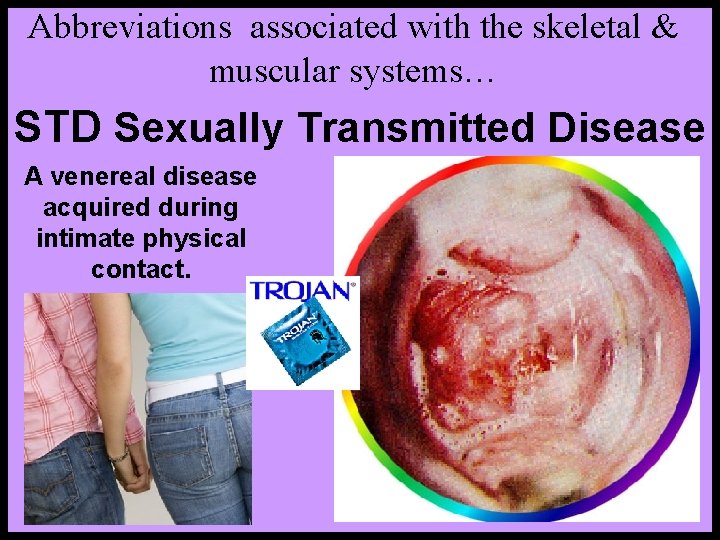 Abbreviations associated with the skeletal & muscular systems… STD Sexually Transmitted Disease A venereal