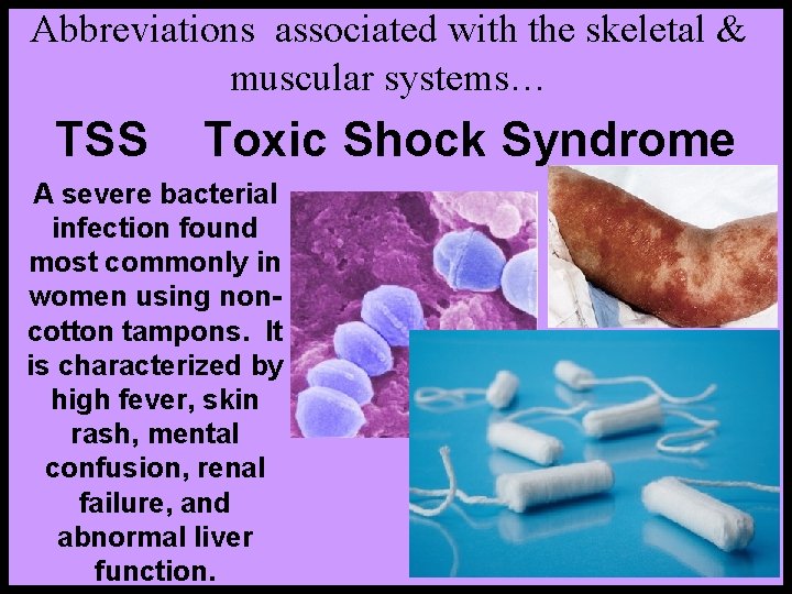 Abbreviations associated with the skeletal & muscular systems… TSS Toxic Shock Syndrome A severe