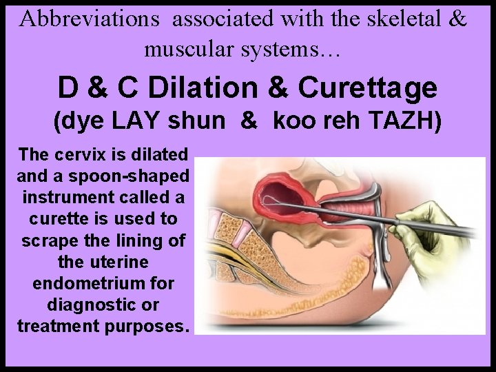 Abbreviations associated with the skeletal & muscular systems… D & C Dilation & Curettage