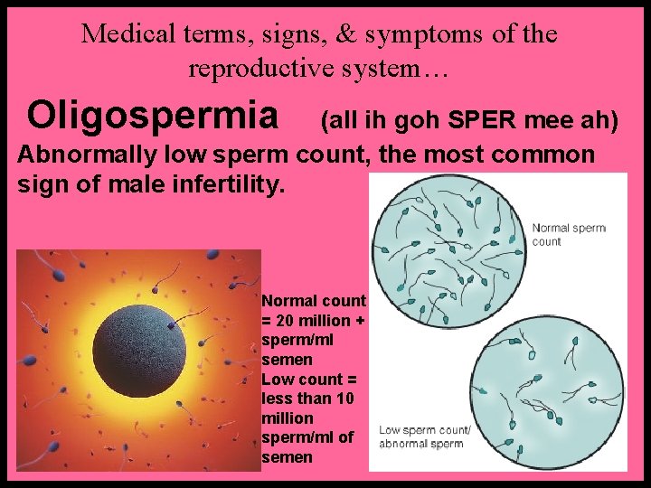 Medical terms, signs, & symptoms of the reproductive system… Oligospermia (all ih goh SPER