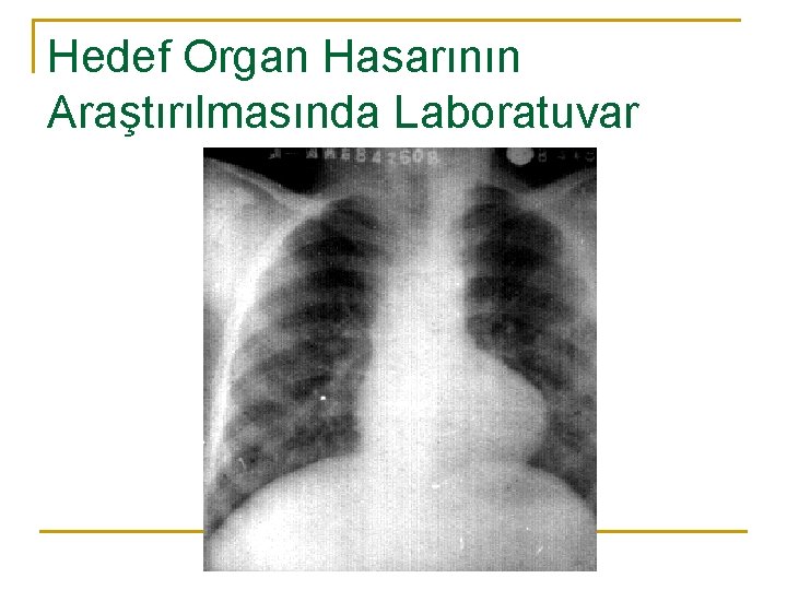 Hedef Organ Hasarının Araştırılmasında Laboratuvar 