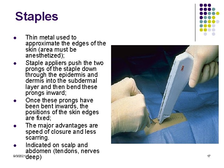 Staples Thin metal used to approximate the edges of the skin (area must be