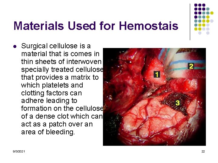 Materials Used for Hemostais l Surgical cellulose is a material that is comes in