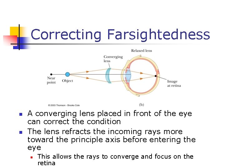 Correcting Farsightedness n n A converging lens placed in front of the eye can