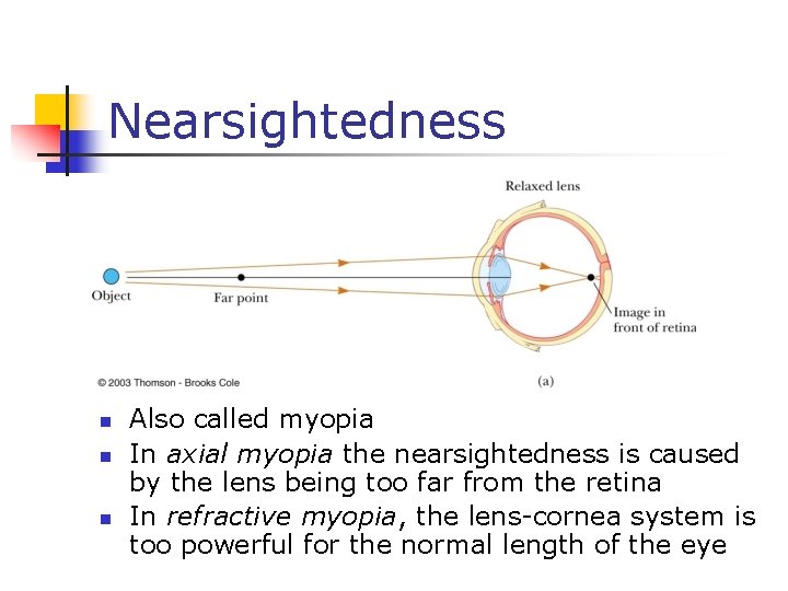 Nearsightedness n n n Also called myopia In axial myopia the nearsightedness is caused