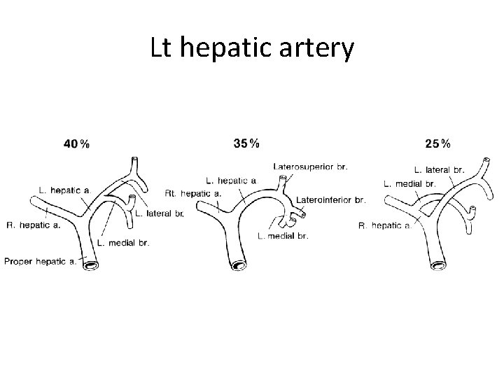 Lt hepatic artery 