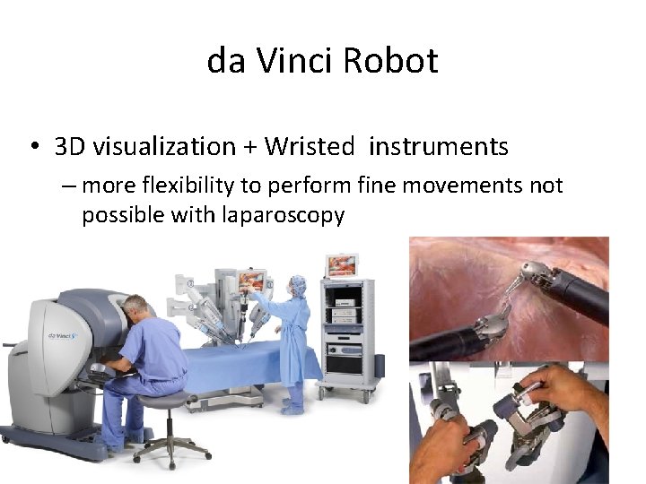 da Vinci Robot • 3 D visualization + Wristed instruments – more flexibility to