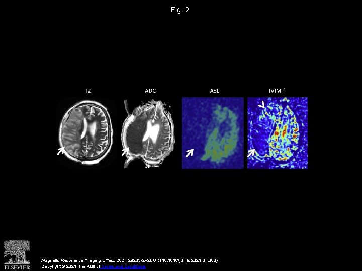 Fig. 2 Magnetic Resonance Imaging Clinics 2021 29233 -242 DOI: (10. 1016/j. mric. 2021.