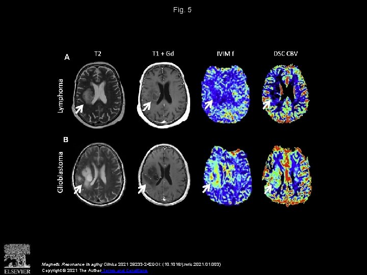Fig. 5 Magnetic Resonance Imaging Clinics 2021 29233 -242 DOI: (10. 1016/j. mric. 2021.