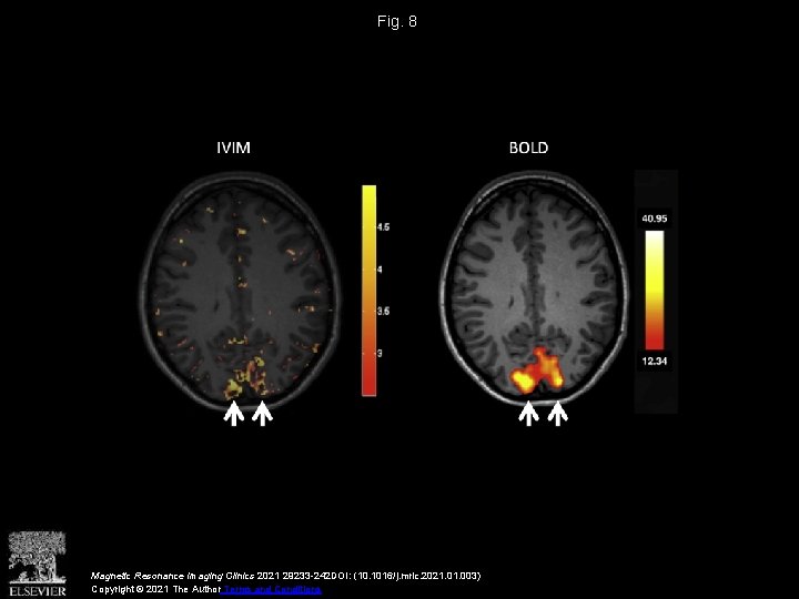 Fig. 8 Magnetic Resonance Imaging Clinics 2021 29233 -242 DOI: (10. 1016/j. mric. 2021.