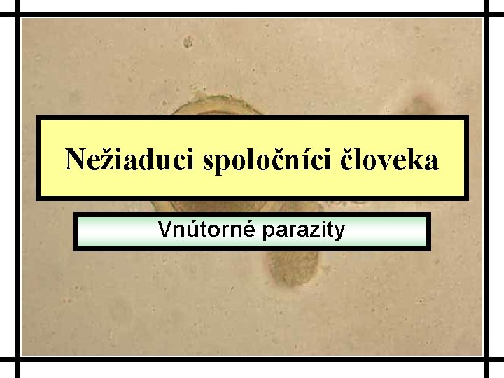 Nežiaduci spoločníci človeka Vnútorné parazity 