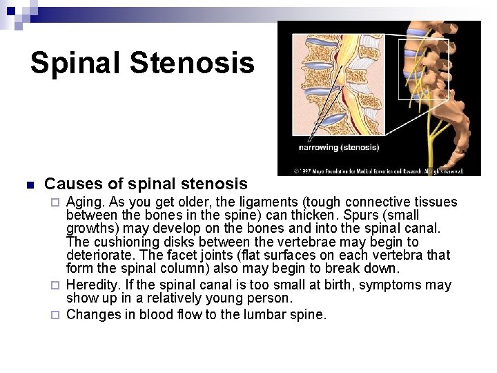 Spinal Stenosis n Causes of spinal stenosis Aging. As you get older, the ligaments