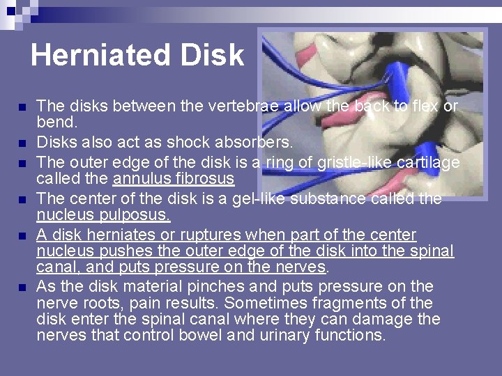 Herniated Disk n n n The disks between the vertebrae allow the back to