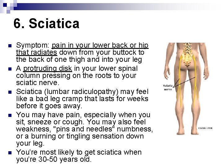 6. Sciatica n n n Symptom: pain in your lower back or hip that