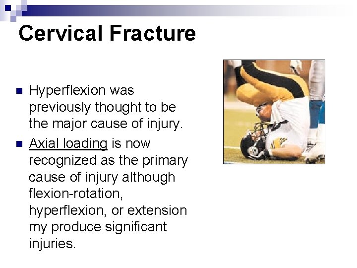 Cervical Fracture n n Hyperflexion was previously thought to be the major cause of