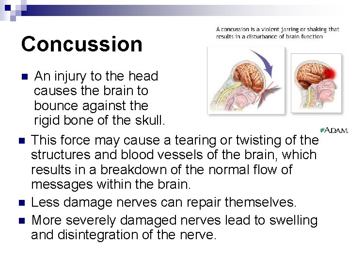 Concussion n n An injury to the head causes the brain to bounce against