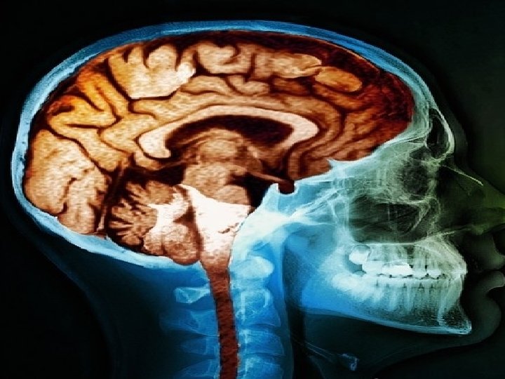 What would an X-ray of your brain full of knowledge look like? • Like