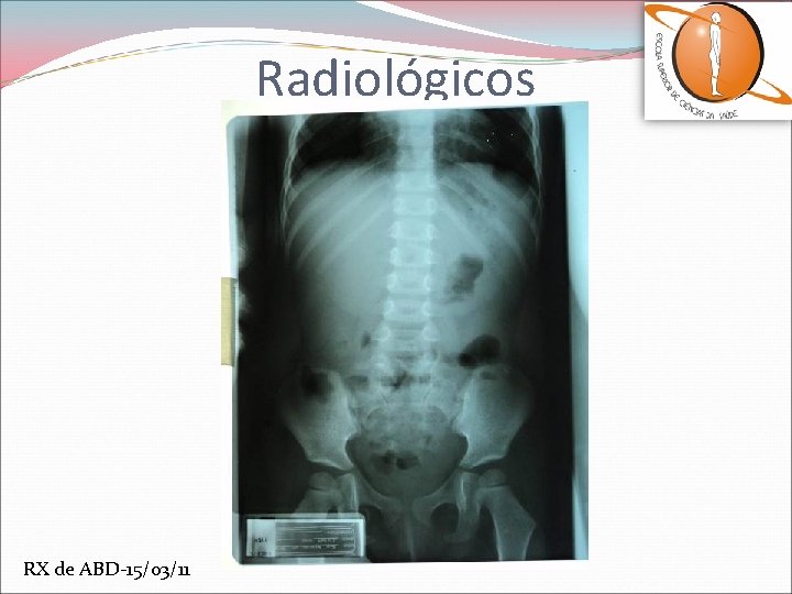 Radiológicos RX de ABD-15/03/11 