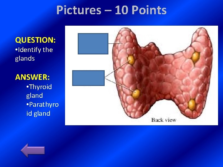 Pictures – 10 Points QUESTION: • Identify the glands ANSWER: • Thyroid gland •