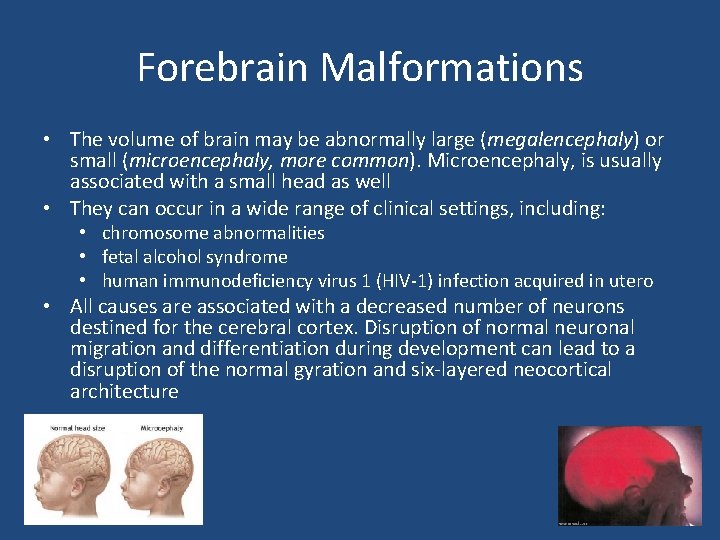 Forebrain Malformations • The volume of brain may be abnormally large (megalencephaly) or small