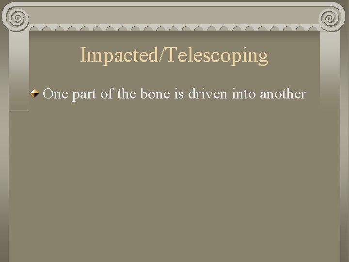 Impacted/Telescoping One part of the bone is driven into another Impacted/Telescoping One part of the bone is driven into another