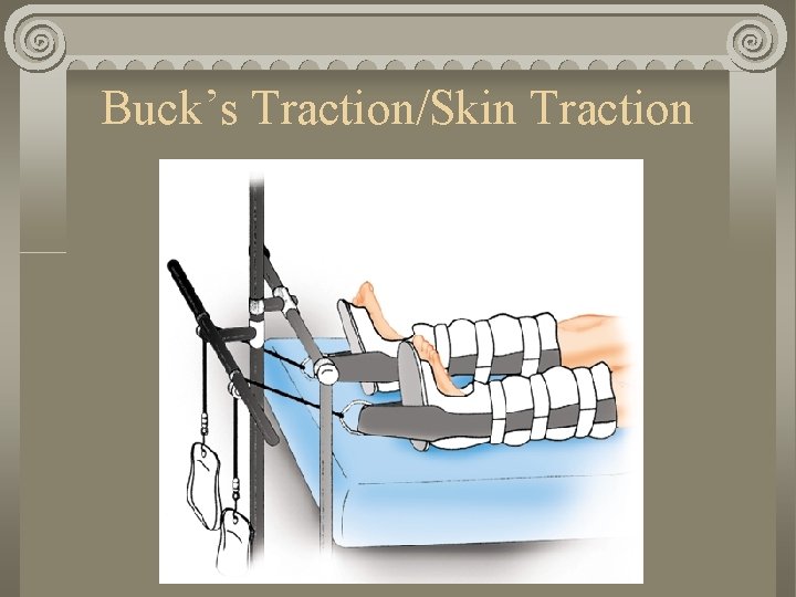 Buck’s Traction/Skin Traction Buck’s Traction/Skin Traction