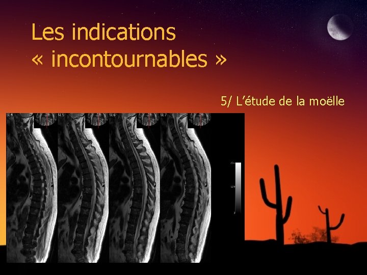 Les indications « incontournables » 5/ L’étude de la moëlle 