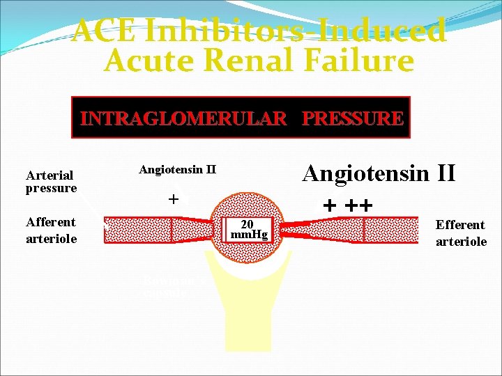 ACE Inhibitors-Induced Acute Renal Failure INTRAGLOMERULAR PRESSURE Arterial pressure Angiotensin II + + Afferent
