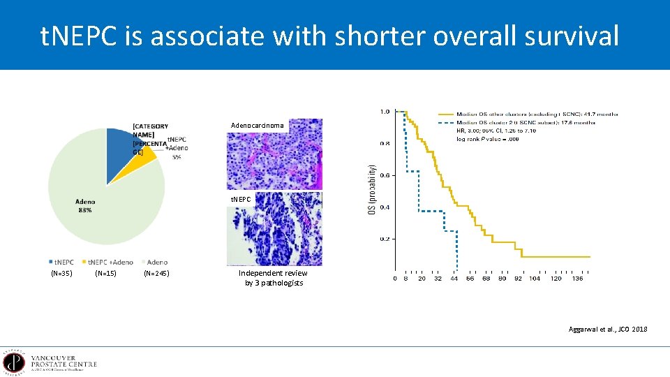 t. NEPC is associate with shorter overall survival Adenocarcinoma t. NEPC (N=35) (N=15) (N=245)