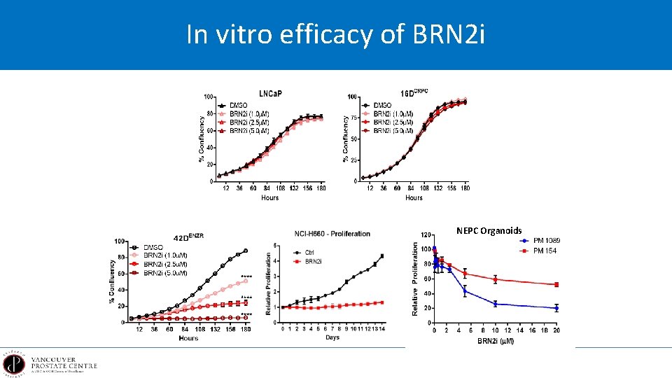 In vitro efficacy of BRN 2 i NEPC Organoids 