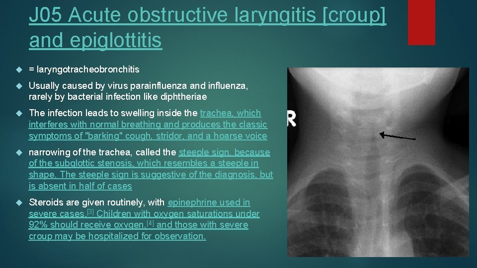 J 05 Acute obstructive laryngitis [croup] and epiglottitis = laryngotracheobronchitis Usually caused by virus