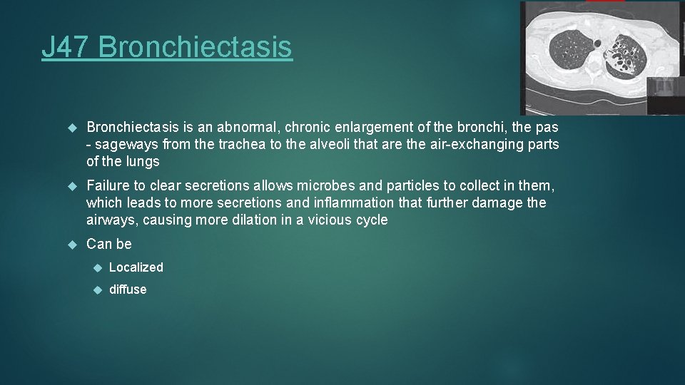 J 47 Bronchiectasis is an abnormal, chronic enlargement of the bronchi, the pas -