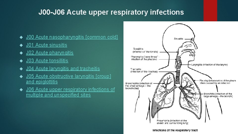 J 00 -J 06 Acute upper respiratory infections J 00 Acute nasopharyngitis [common cold]