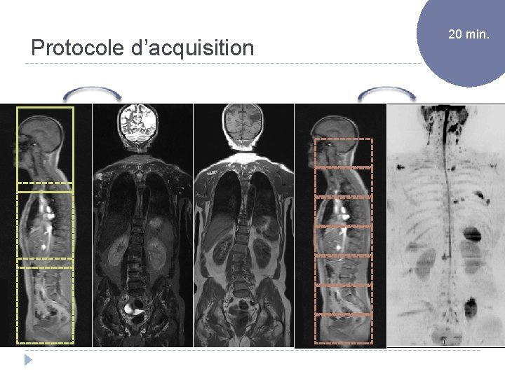 Protocole d’acquisition 11 20 min. 