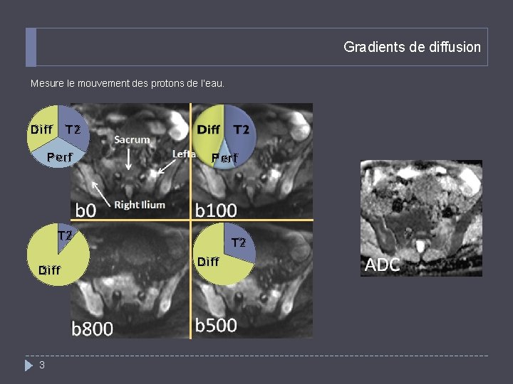 Gradients de diffusion Mesure le mouvement des protons de l’eau. Diff T 2 Perf