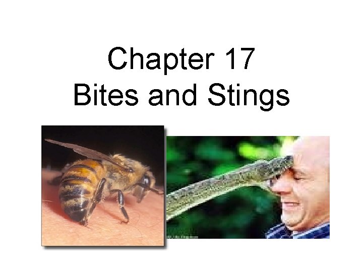 Chapter 17 Bites and Stings 