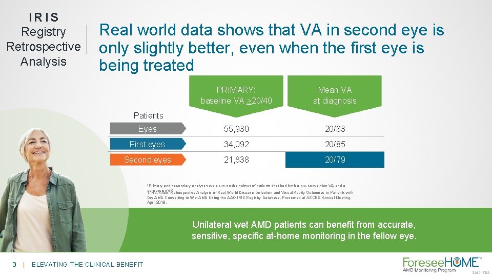 IRIS Registry Retrospective Analysis Real world data shows that VA in second eye is
