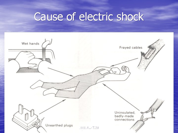 Cause of electric shock Issa AL-Tobi 