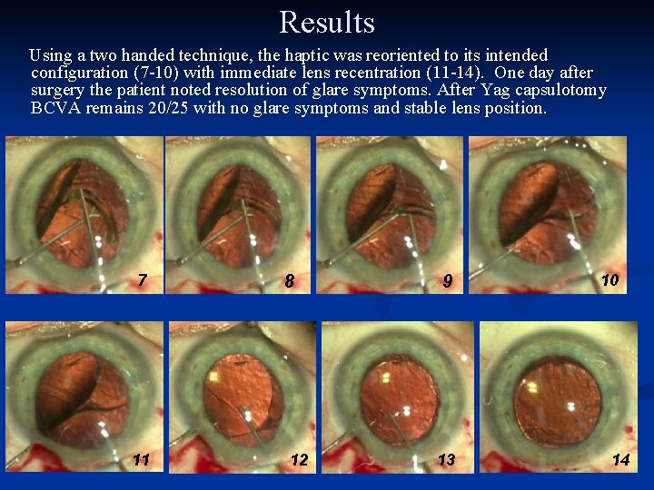 Results Using a two handed technique, the haptic was reoriented to its intended configuration
