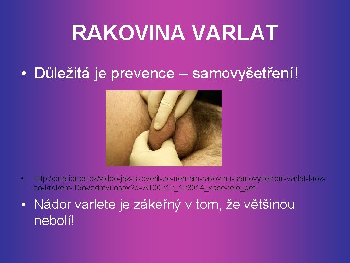 RAKOVINA VARLAT • Důležitá je prevence – samovyšetření! • http: //ona. idnes. cz/video-jak-si-overit-ze-nemam-rakovinu-samovysetreni-varlat-krokza-krokem-15 a-/zdravi.