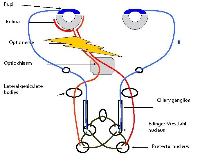 Pupil Retina Optic nerve III Optic chiasm Lateral geniculate bodies Ciliary ganglion Edinger-Westfahl nucleus