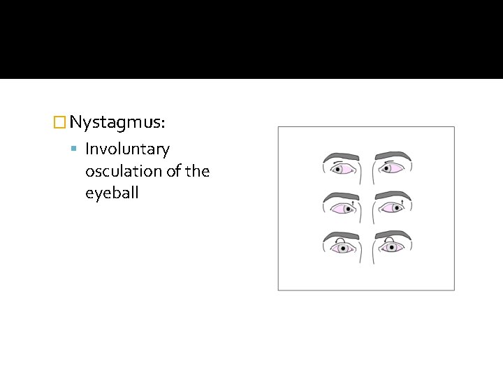 � Nystagmus: Involuntary osculation of the eyeball 