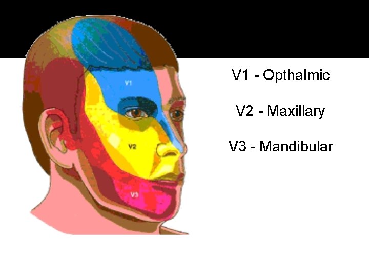 V 1 - Opthalmic V 2 - Maxillary V 3 - Mandibular 