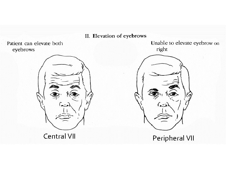 Central VII Peripheral VII 