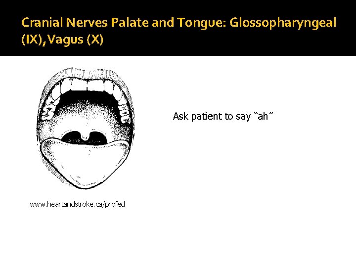 Cranial Nerves Palate and Tongue: Glossopharyngeal (IX), Vagus (X) Ask patient to say “ah”