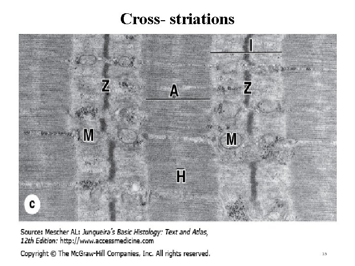 Cross- striations 15 