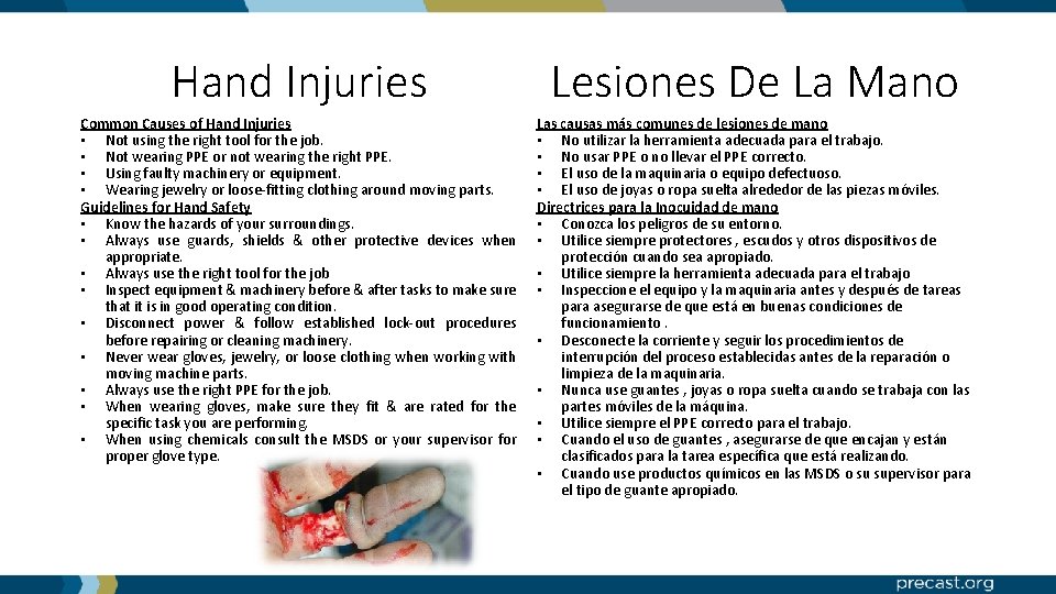 Hand Injuries Lesiones De La Mano Common Causes of Hand Injuries • Not using