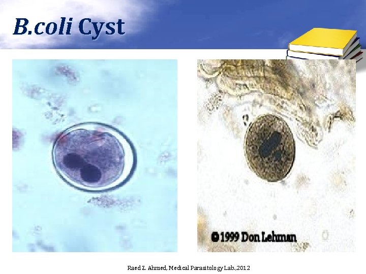 B. coli Cyst Raed Z. Ahmed, Medical Parasitology Lab. , 2012 