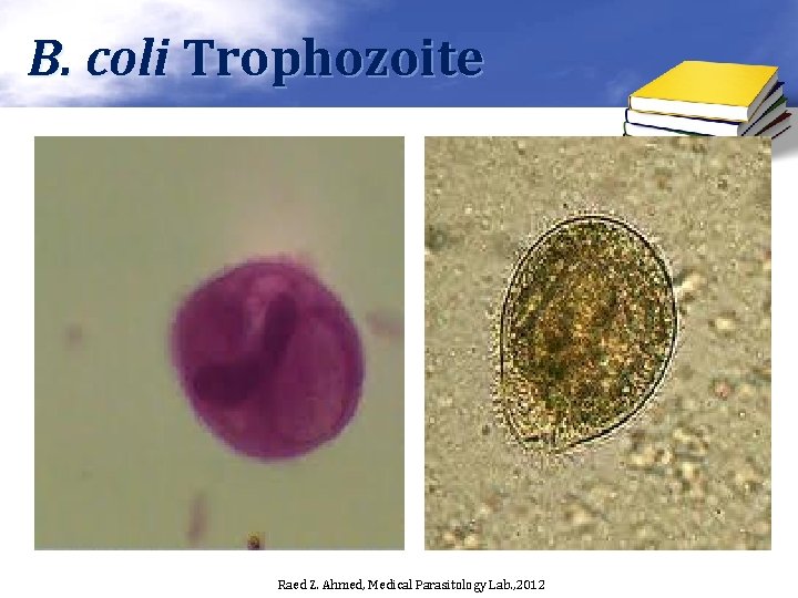 B. coli Trophozoite Raed Z. Ahmed, Medical Parasitology Lab. , 2012 